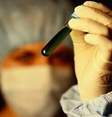 cara melakukan tes parasit