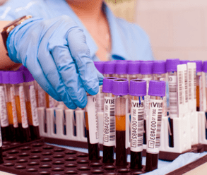tes darah untuk parasit