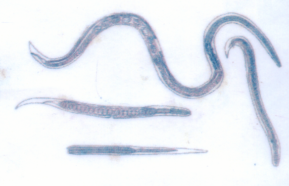 Cacing Guinea, yang menjadi parasit di bawah kulit, mudah terinfeksi