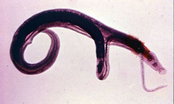Schistosomes adalah salah satu parasit yang paling umum dan berbahaya
